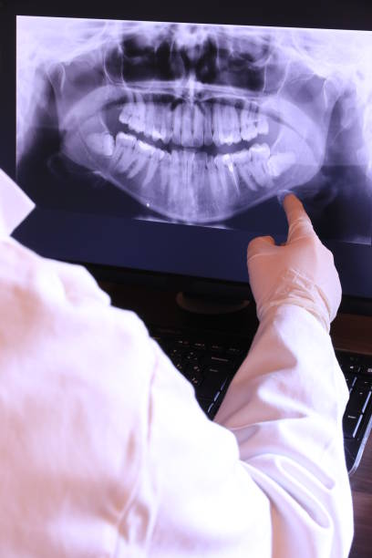 Best Emergency Tooth Extraction in Gorevle, IL